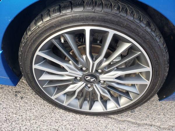 2018 Hyundai Elantra Sport AUTOCHECK AVAILABLE ! for sale in El Paso, TX – photo 9