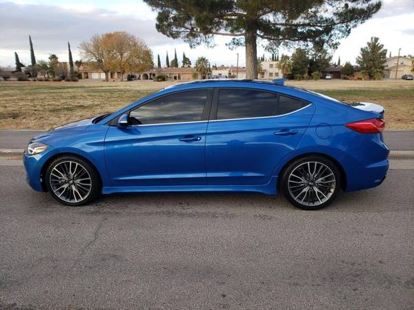 2018 Hyundai Elantra Sport AUTOCHECK AVAILABLE ! for sale in El Paso, TX – photo 3